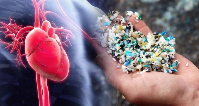 Microplastiche nell'ambiente e nei cibi che ingeriamo, un pericolo reale per la salute